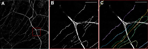 图3：thy1-YFP小鼠角膜中的神经元。