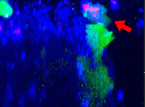 Fig. 2: NK cell line KHYG-1 (green) changing shape while attacking and killing HT-29 tumor cells labeled with cetuximab (blue). PI uptake (red) indicates cell death. 22h