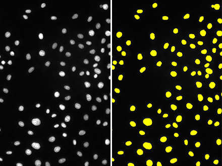 图3：使用设置亮度阈值的常规方法在具有足够亮度的荧光图像（左）中进行细胞核识别（右）的结果。