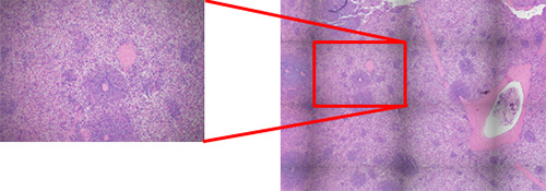 図4 – シェーディング（輝度の不均一性）は、画像貼り合わせにより顕著になります（右）。個別のFOV画像（左）よりも不明瞭です。