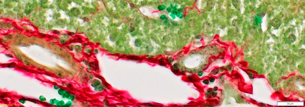 Mouse liver tissue. Thickness: 4μm, staining: Picro-Sirius-Red & Fast-Green (Labor: Medizinische Universität Wien, Innere Medizin III, HEPEX Labor für Portale Hypertension und Fibrose bei Lebererkrankungen, Austria)