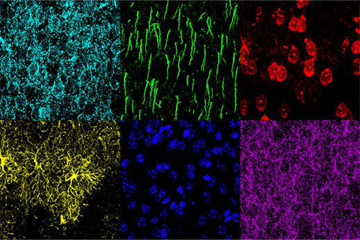 Abbildung 3: Maus-mPFC, gefärbt mit saurem Gliafibrillenprotein (GFAP; Astrozytenfärbung; gelb), Calmodulin-abhängiger Proteinkinase II (CaMKII; Pyramidenneuronenfärbung; rot), Amphoterin-induziertes-Protein-1-Vorstufe (AMIGO-1; neuronale Membranmarkierung) ; Cyan), Parvalbumin (PV; inhibitorische Neuronenfärbung; lila), Ankyrin-G (AnkG; Axon-Initialsegmentfärbung; grün) und Nuclear Yellow (Kernfärbung; blau). (A) Einzelne Kanäle der sechs Fluorophore. (B) Überlagertes Bild