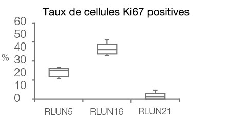 Taux de cellules Ki67 positives
