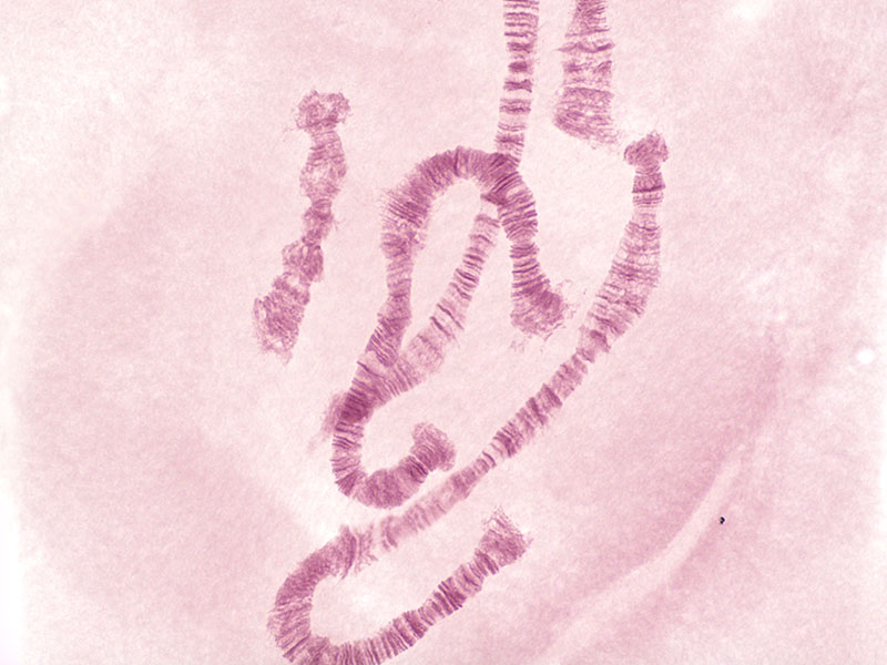 Échantillon : chromosomes polytènes ; microscope : CX23, objectif : planachromatique 40x (ON 0,65), adaptateur TV : U-TV0.5XC-3, éclairage : fond clair (LED), temps d’exposition : 16,9 ms.