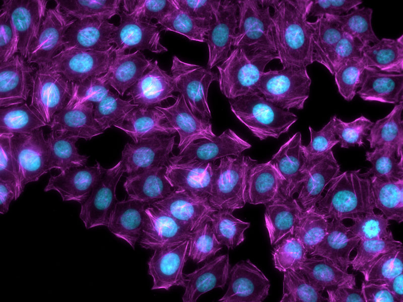 HeLa cells: cyan: DAPI, cell nuclei, magenta: Cy5, actin filaments