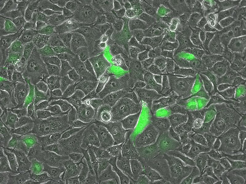 HeLa cells expressing GFP cytoplasm