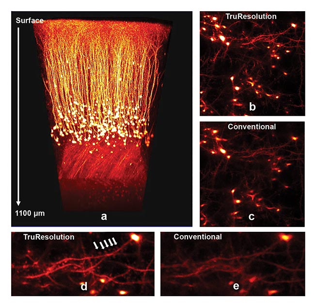 In vivo deep imaging of dendritic spines