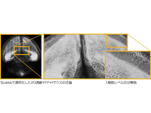 Image data courtesy of Hiroshi Hama, Atsushi Miyawaki, RIKEN Brain Science Institute Laboratory for Cell Function Dynamics