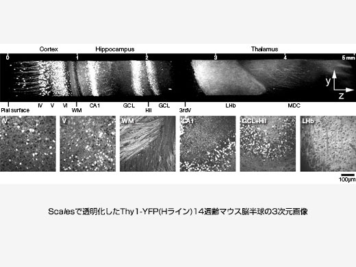 Image data courtesy of Hiroshi Hama, Atsushi Miyawaki, RIKEN Brain Science Institute Laboratory for Cell Function Dynamics Reference: Nat Neurosci. 2015 Oct; 18 (10): 1518–29. doi: 10.1038/nn.4107. Epub 2015 Sep 14.
