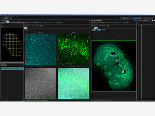 3D Mosaic Imaging and Stitching