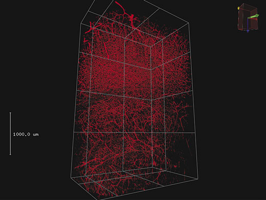Pilha 3D de 4 mm em etiqueta de vaso sanguíneo com Texas Red em um cérebro de rato