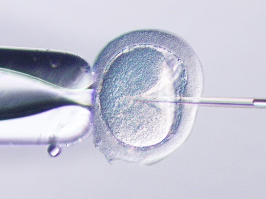 IX73SC | Assisted Reproductive Microscope for a Streamlined IVF 