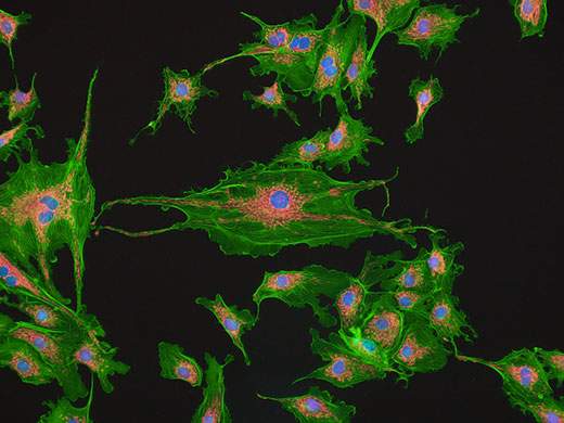 Cellules endothéliales artérielles pulmonaires bovines (BPAE) marquées au MitoTracker Red CMXRos, à l’Alexa Fluor 488 Phalloidin et au DAPI.
