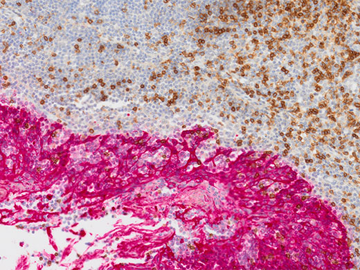 Investigación oncológica y de células madres