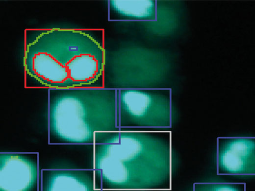 Segmentierung von Zellen mit 2 Zellkernen und Zählung von Mikrokernen. Bild mit freundlicher Genehmigung der Abteilung für In-Vitro-Toxikologie, Fraunhofer-Institut für Toxikologie und Experimentelle Medizin (ITEM), Hannover, Deutschland