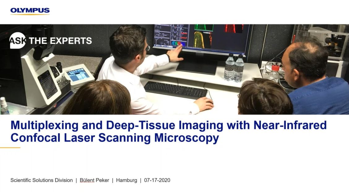 Multiplexación e imágenes de tejidos profundos a partir de una microscopía de escaneo láser confocal del infrarrojo cercano