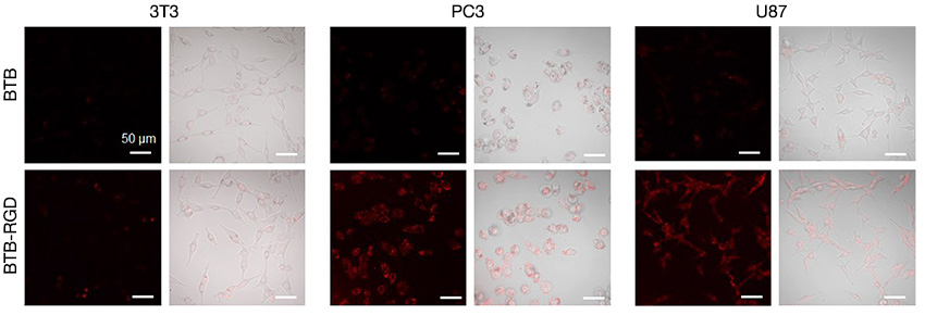 Comparaison d’images confocales de cellules de souris après injection des nanosondes BTB-RGD ou BTB