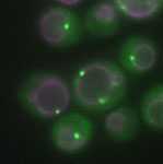 Imagem mesclada de Atg17 (verde) Vacúolos de autofagossoma (magenta)