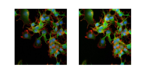 蛍光顕微鏡によるNG108-15細胞の画像比較