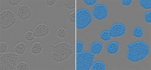 Sample images of induced pluripotent stem (iPS) cells  Left: raw image, Right: analysis image