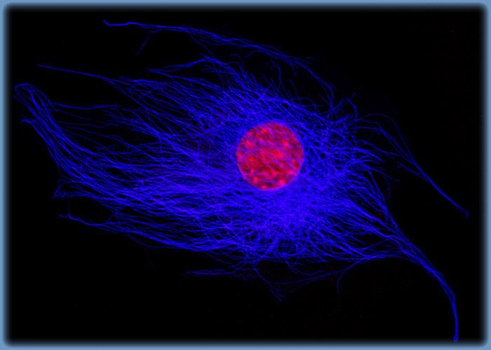 Mouse Hemangioendothelioma Endothelial Cells (EOMA Line)