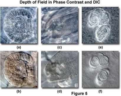 Differential Interference Contrast - Comparison of Phase Contrast and DIC  Microscopy | オリンパス ライフサイエンス