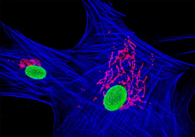 Mongoose Skin Fibroblast Cells APM Olympus LS