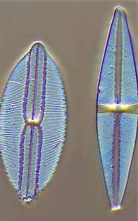 diatoms under microscope labeled
