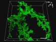 Observación 3D de hígado de ratón clarificado usando el microscopio FLUOVIEW FV3000