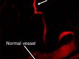 Distinguindo vasos sanguÌneos cerebrais e tumorais em tecidos profundos usando microscopia multifÛton
