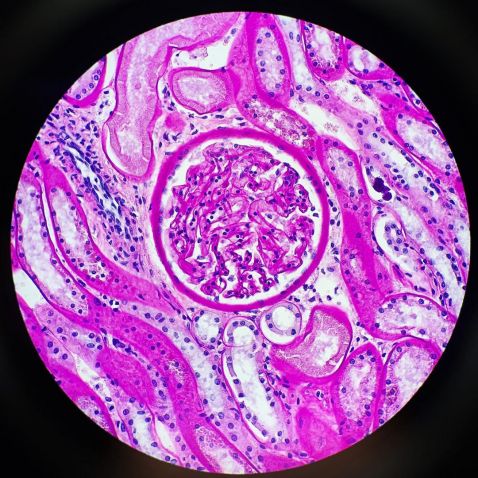 Kidney section under the microscope