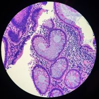 顕微鏡で見たヒト結腸