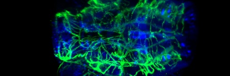 ライトシート蛍光顕微鏡Alpha3で撮影した、透明化したゼブラフィッシュ幼虫の頭部血管と神経の染色