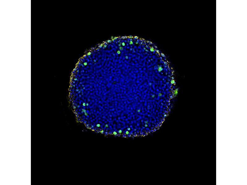 Imagem de aplicação de esferoide de célula HeLa esclarecida
