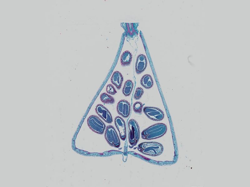 Imagen aplicativa de bolsa de pastor: embrión maduro de Capsella