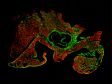 Mapping Aortic Valve Cells Using the FLUOVIEW FV3000 Microscope