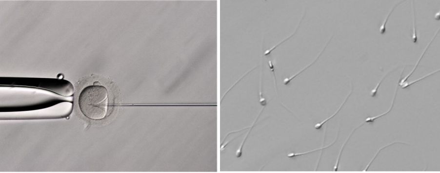 生殖補助技術のホフマン変調コントラスト画像