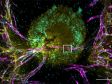 Observing a Vascularized Tumor Spheroid on a Chip with a Confocal Microscope
