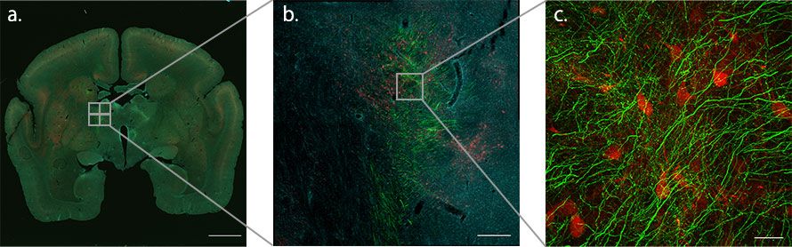 图2.使用宏观到微观功能绘制轴突纤维在从狨猴大脑的PFC到丘脑的途中与TRN相遇的位置。由于TRN神经元由PV阳性抑制性神经元组成，因此可以通过PV抗体（红色）加以识别。绿色代表来自大脑皮层的轴突末梢，青色代表细胞核。