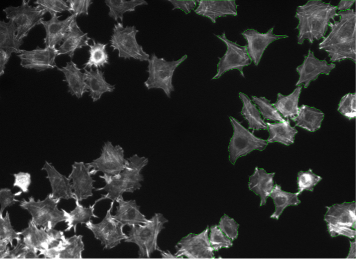 Deep learning image segmentation of Rat-1 cells