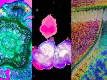 Breadth of Beauty—Our Most Popular Microscope Images for August 2023