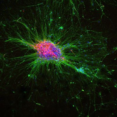 Microscope image of iPSC-derived organoid differentiated to produce dopaminergic neurons.