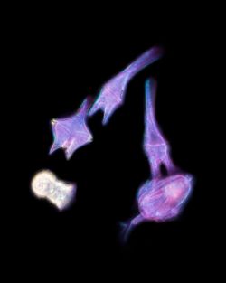 Harmful algal bloom of the dinoflagellate Tripos hircus
