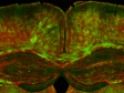 알츠하이머병에 대한 뇌 미엘린 연구를 발전시키는 회전 디스크 공초점 현미경