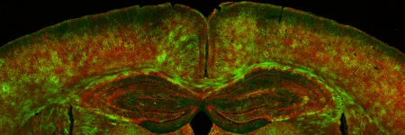 Myelin-Forschung im Zusammenhang mit Alzheimer