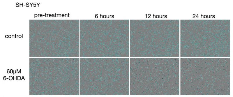 Abbildung 3: Bilder von SH-SY5Y-Zellen nach 6-OHDA-Behandlung.