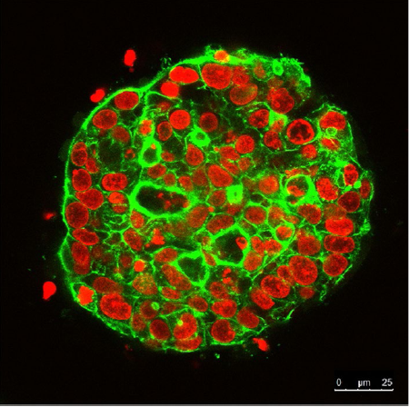 Image confocale de sphères de cellules en culture 3D