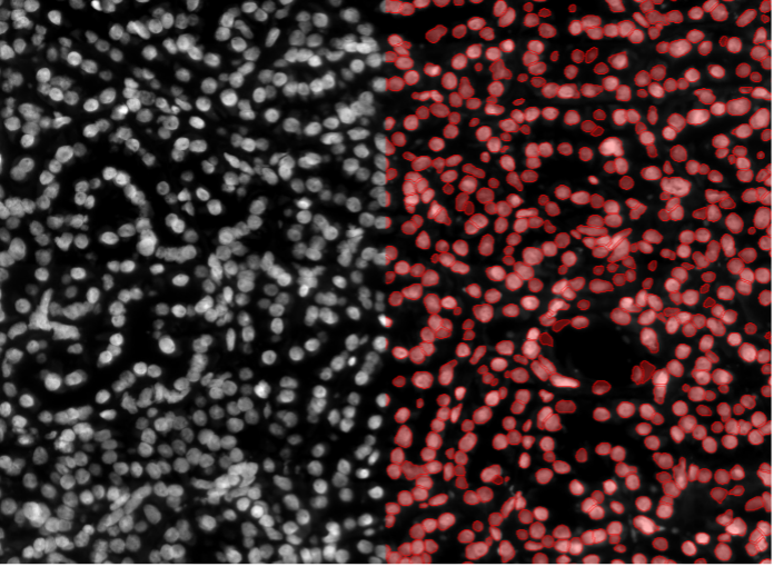 Deep learning image segmentation of human tissue tumor cells