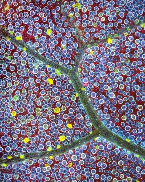 Surface foliaire d’atriplex observée au microscope