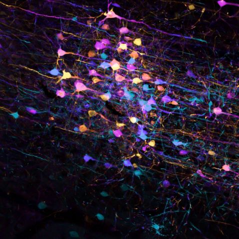 Coupe de tissu d’un cerveau de souris observée au microscope